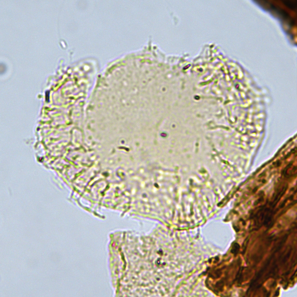 Circulodinium distinctum, U1581-55R-CC, sl. 1, E20-2, foto4.jpg